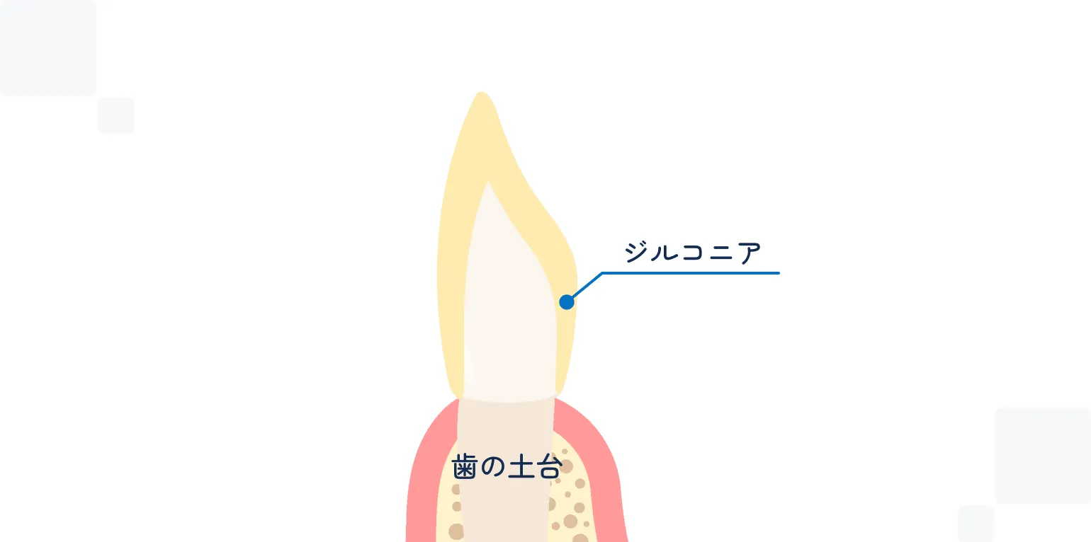 フルジルコニア