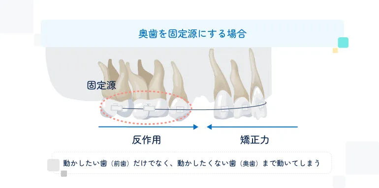 奥歯を固定源にする場合