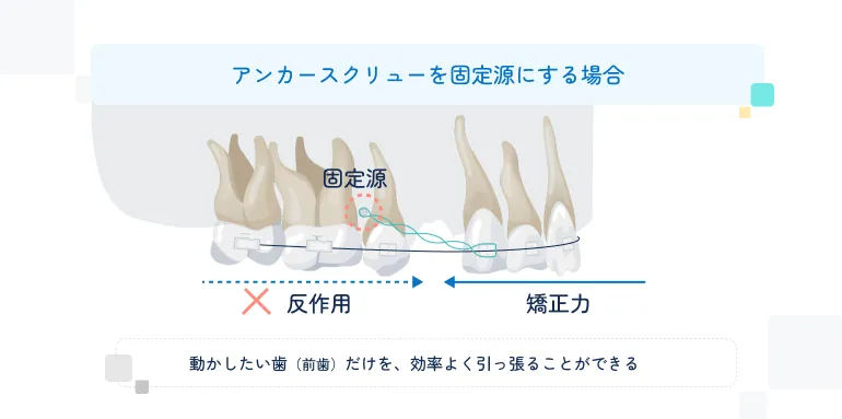 アンカースクリューを固定源にする場合