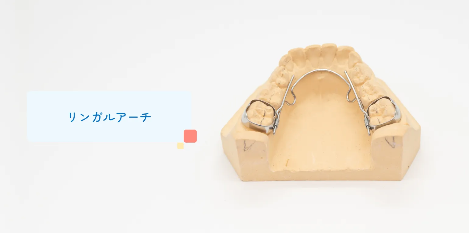 リンガルアーチ
