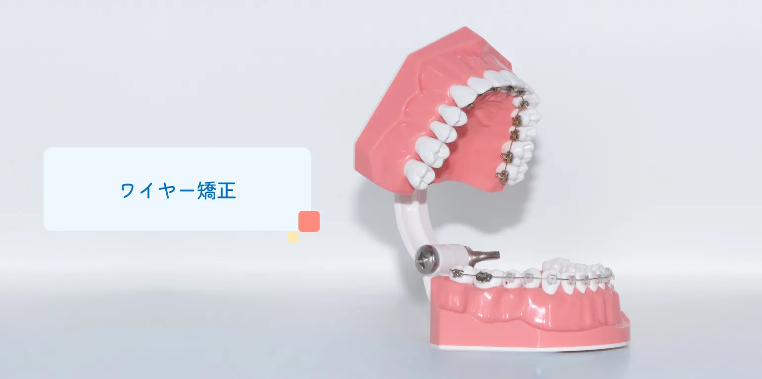 成人矯正の主な治療方法